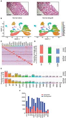 The cellular landscape of the normal kidney allograft: Main players balancing the alloimmune response